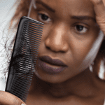 hair loss dermatologist