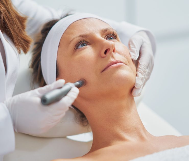 microneedling costs