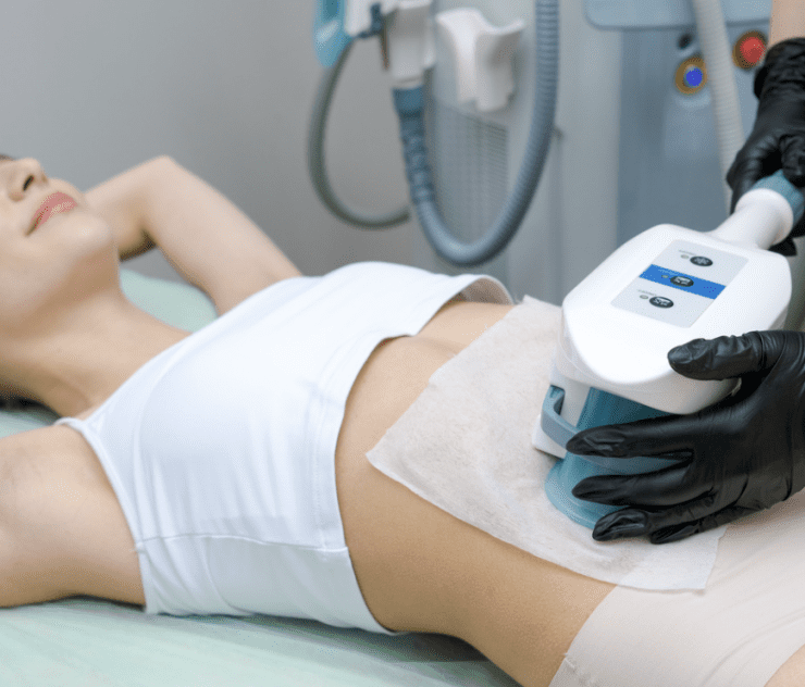 coolsculpting cost