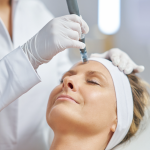 microneedling and prp cost