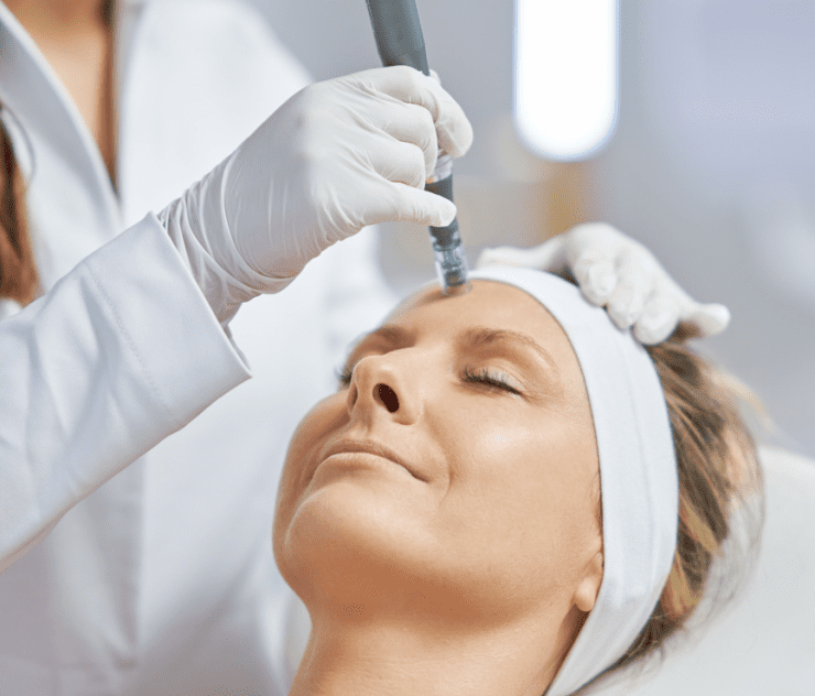 microneedling and prp cost