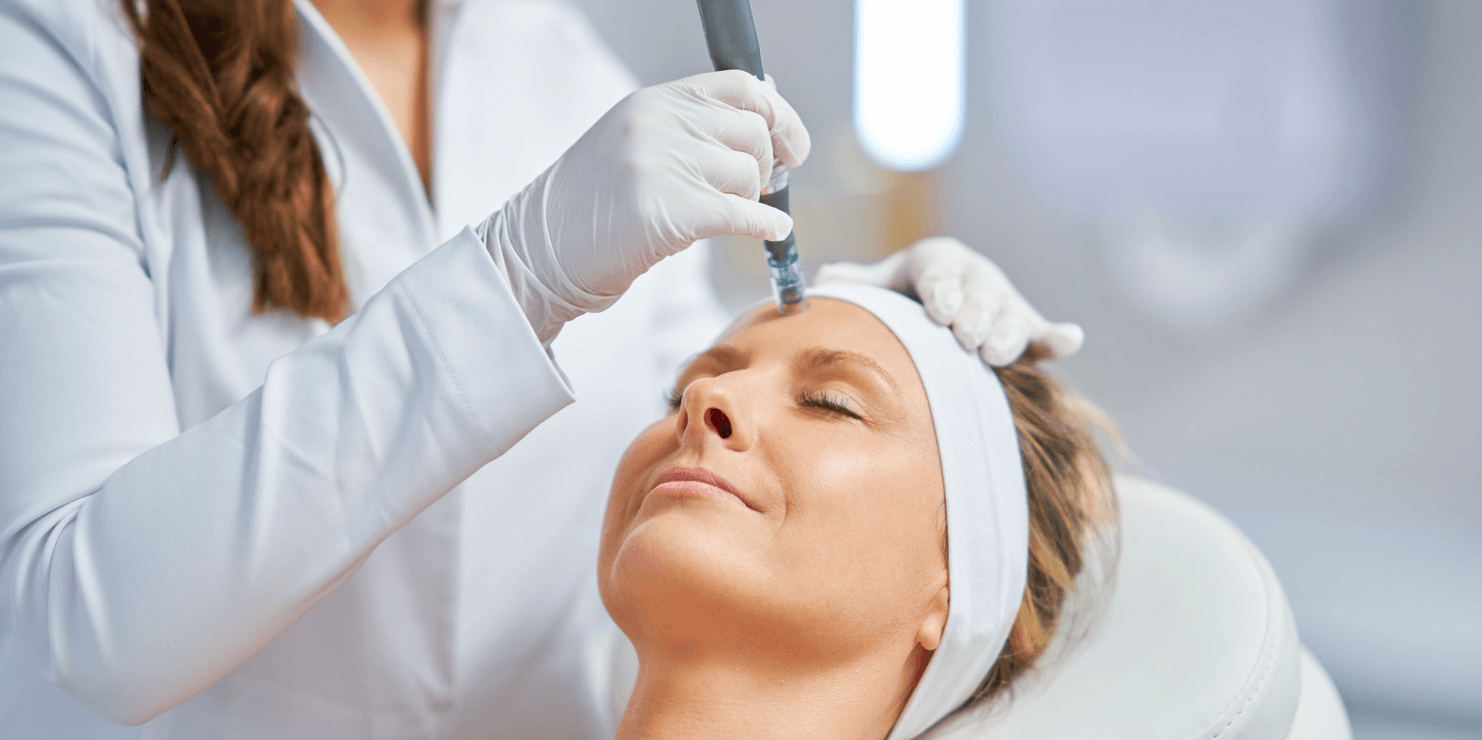 microneedling and prp cost