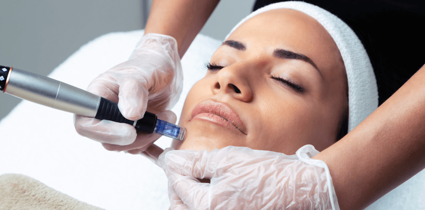 Microneedling Cost