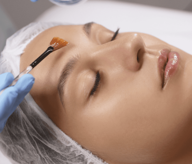 are chemical peels dangerous