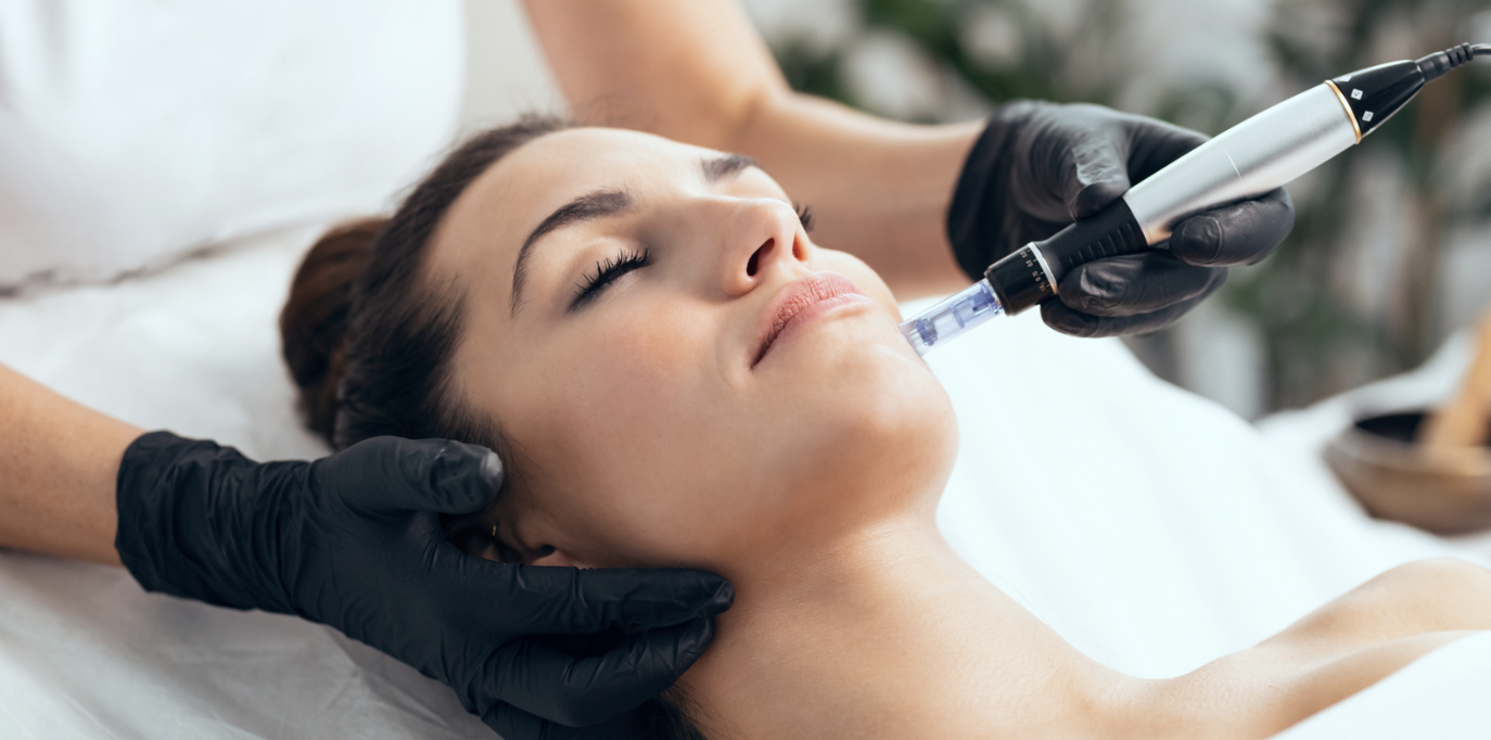best microneedling and prp