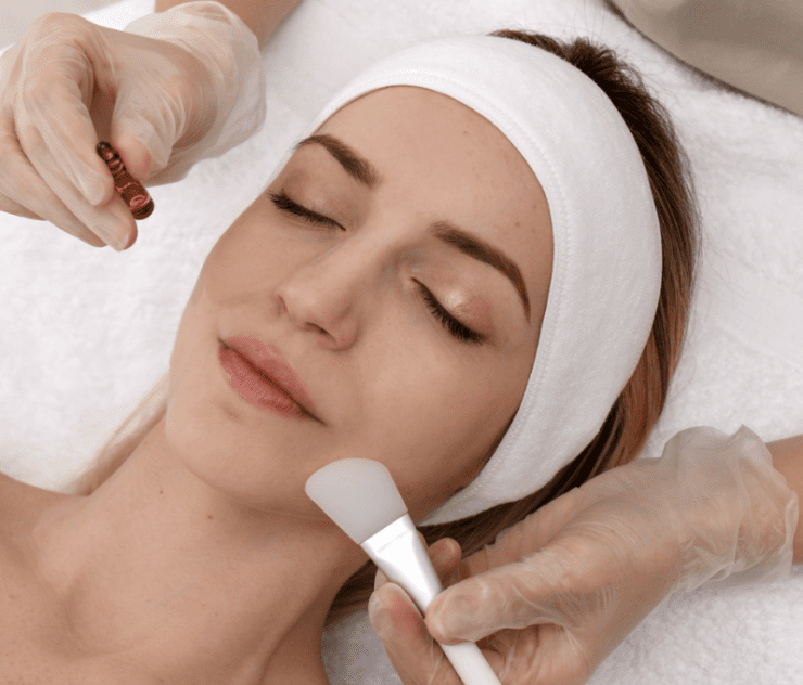 how long do chemical peels last