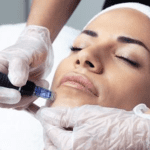 microneedling cost