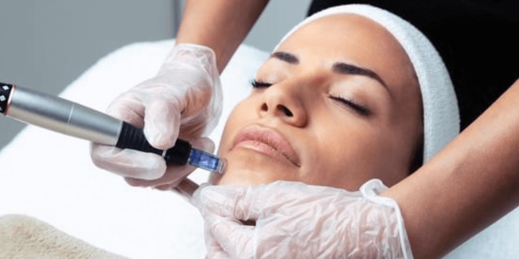 microneedling cost