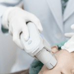 ultherapy skin tightening