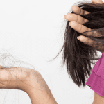 hair loss specialist