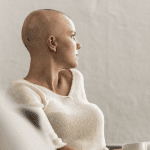 Alopecia Specialist in Largo