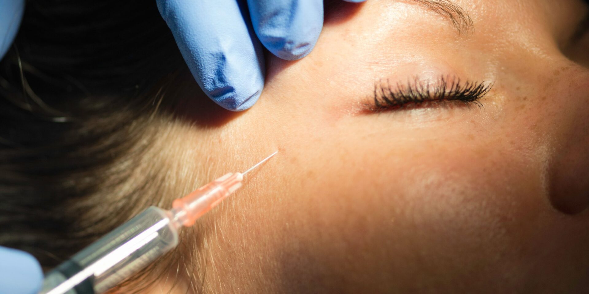 Same-Day Botox in Upper Marlboro